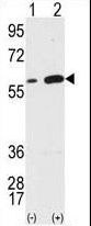 Vimentin Antibody - Western blot of Vimentin (arrow) using Vimentin Antibody. 293 cell lysates (2 ug/lane) either nontransfected (Lane 1) or transiently transfected with the VIM gene (Lane 2) (Origene Technologies).