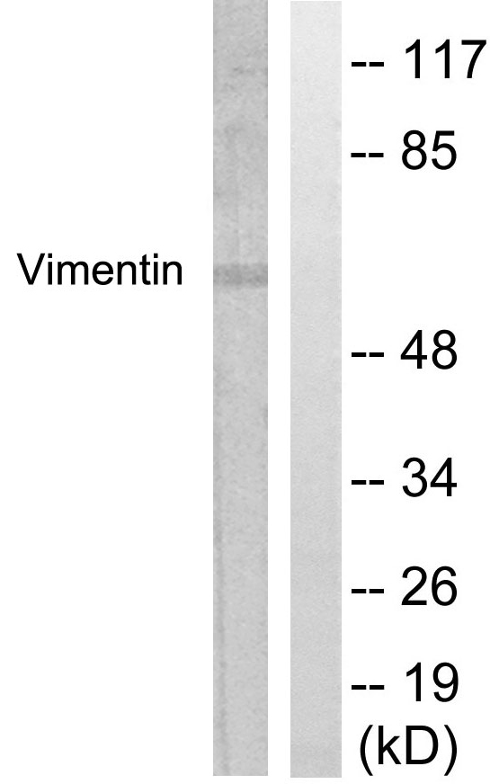 Vimentin Antibody - Western blot analysis of lysates from A549 cells, treated with Nocodazole 1ug/ml 16h, using Vimentin Antibody. The lane on the right is blocked with the synthesized peptide.