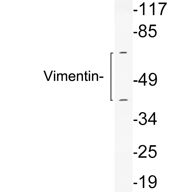 Vimentin Antibody - Western blot analysis of lysates from 293 cells, using Vimentin antibody.