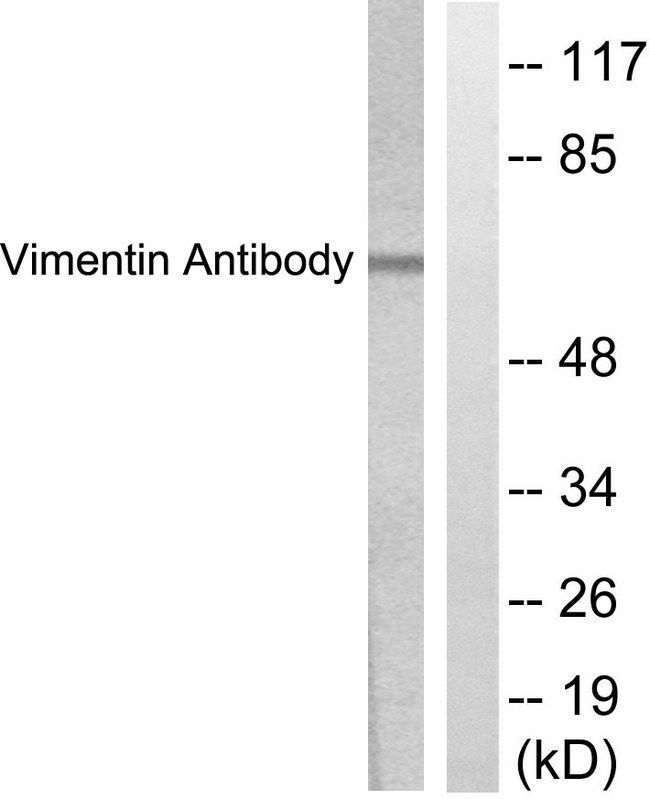 Vimentin Antibody - Western blot analysis of lysates from HepG2 cells, treated with Adriamycin 0.5uM 5h, using Vimentin Antibody. The lane on the right is blocked with the synthesized peptide.