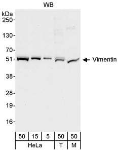 Vimentin Antibody - Detection of Human and Mouse Vimentin by Western Blot. Samples: Whole cell lysate from HeLa (5, 15 and 50 ug), 293T (T; 50 ug), and mouse NIH3T3 (M; 50 ug) cells. Antibody: Affinity purified rabbit anti-Vimentin antibody used for WB at 0.04 ug/ml. Detection: Chemiluminescence with an exposure time of 10 seconds.