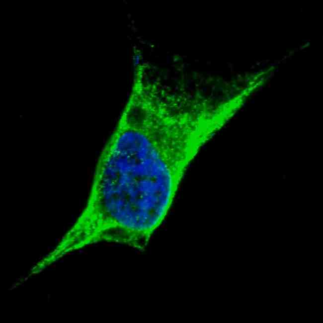 Vimentin Antibody - Fluorescent confocal image of SY5Y cells stained with Vimentin antibody. SY5Y cells were fixed with 4% PFA (20 min), permeabilized with Triton X-100 (0.2%, 30 min). Cells were then incubated Vimentin primary antibody (1:100, 2 h at room temperature). For secondary antibody, Alexa Fluor 488 conjugated donkey anti-rabbit antibody (green) was used (1:1000, 1h). Nuclei were counterstained with Hoechst 33342 (blue) (10 ug/ml, 5 min). Note the highly specific localization of the Vimentin immunosignal to the cytoskeleton, supported by Human Protein Atlas Data (http://www.proteinatlas.org/ENSG00000026025).