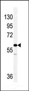 Vimentin Antibody - Western blot of Vimentin antibody in NCI-H460 cell line lysates (35 ug/lane). Vimentin (arrow) was detected using the purified antibody.