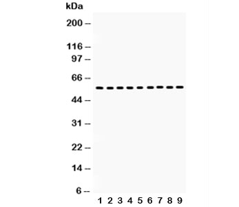 Vimentin Antibody - Western blot testing of Vimentin antibody and Lane 1: HT1080; 2: NIH3T3; 3: Jurkat; 4: HUT; 5: MCF-7; 6: HeLa; 7: human placenta; 8: rat testis; 9: mouse testis lysate