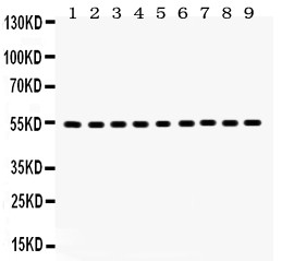 Vimentin Antibody - Vimentin antibody Western blot. All lanes: Anti Vimentin at 0.5 ug/ml. Lane 1: HT1080 Whole Cell Lysate at 40 ug. Lane 2: NIH Whole Cell Lysate at 40 ug. Lane 3: JURKAT Whole Cell Lysate at 40 ug. Lane 4: HUT Whole Cell Lysate at 40 ug. Lane 5: MCF-7 Whole Cell Lysate at 40 ug. Lane 6: HELA Whole Cell Lysate at 40 ug. Lane 7: Human Placenta Tissue Lysate at 50 ug. Lane 8: Rat Testis Tissue Lysate at 50 ug. Lane 9: Mouse Testis Tissue Lysate at 50 ug. Predicted band size: 54 kD. Observed band size: 54 kD.