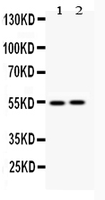 Vimentin Antibody - anti-Vimentin Picoband antibody Western blotting All lanes: Anti Vimentin at 0.5ug/ml Lane 1: Rat Kidney Tissue Lysate at 50ug Lane 2: Mouse Kidney Tissue Lysate at 50ug Predicted bind size: 54KD Observed bind size: 54KD