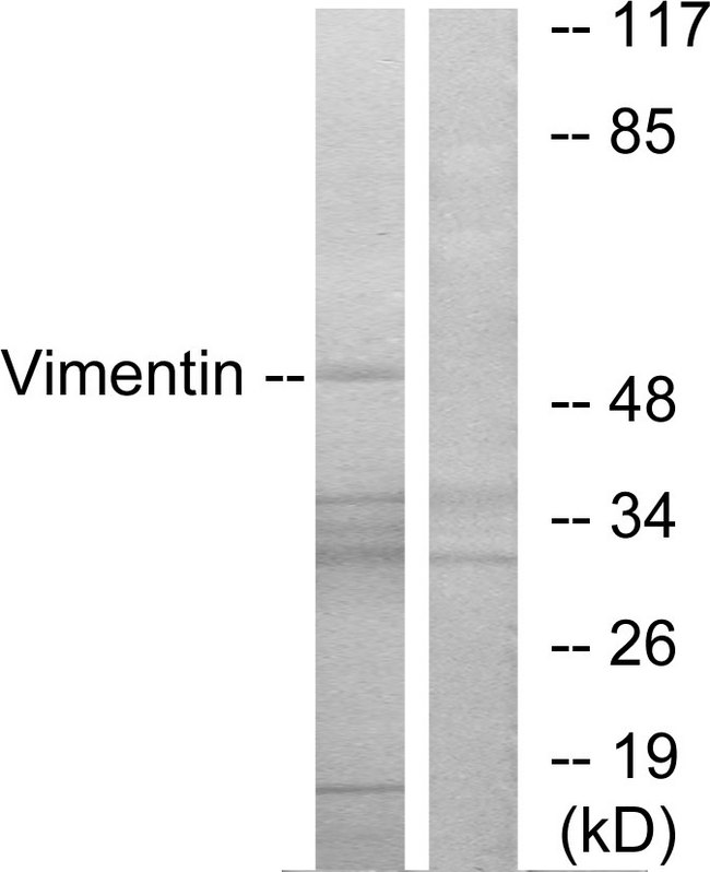 Vimentin Antibody - Western blot analysis of lysates from 293 cells, treated with EGF 200ng/ml 30', using Vimentin Antibody. The lane on the right is blocked with the synthesized peptide.