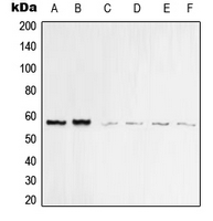 Vimentin Antibody - Western blot analysis of Vimentin expression in MCF7 (A); MDAMB435 (B); KNRK (C); HeLa (D); Raw264.7 (E); PC12 (F) whole cell lysates.