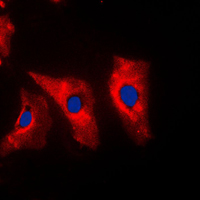 Vimentin Antibody - Immunofluorescent analysis of Vimentin staining in MCF7 cells. Formalin-fixed cells were permeabilized with 0.1% Triton X-100 in TBS for 5-10 minutes and blocked with 3% BSA-PBS for 30 minutes at room temperature. Cells were probed with the primary antibody in 3% BSA-PBS and incubated overnight at 4 C in a humidified chamber. Cells were washed with PBST and incubated with a DyLight 594-conjugated secondary antibody (red) in PBS at room temperature in the dark. DAPI was used to stain the cell nuclei (blue).