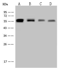 Vimentin Antibody - Anti-VIM rabbit monoclonal antibody at 1:500 dilution. Lane A: Hela Whole Cell Lysate. Lane B: A549 Whole Cell Lysate. Lane C: 293T Whole Cell Lysate. Lane D: Jurkat Whole Cell Lysate. Lysates/proteins at 30 ug per lane. Secondary: Goat Anti-Rabbit IgG (H+L)/HRP at 1/10000 dilution. Developed using the ECL technique. Performed under reducing conditions. Predicted band size: 54 kDa. Observed band size: 55 kDa.