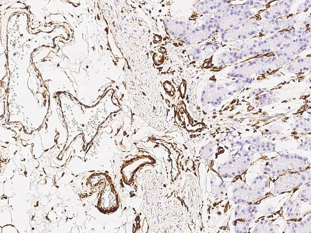 Vimentin Antibody - Immunochemical staining of human Vimentin in human stomach with rabbit monoclonal antibody at 1:10000 dilution, formalin-fixed paraffin embedded sections.