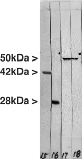 Vimentin Antibody - Western blot of crude extract of the human carcinoma MCA-2A52 clone. Lane 15 was probed with our antibody to actin, giving an SDS-PAGE molecular weight of 42kDa, and lane 16 with MCA-3G12, our antibody to 14-3-3 eta, which has an SDS-PAGE molecular weight of 28kDa.