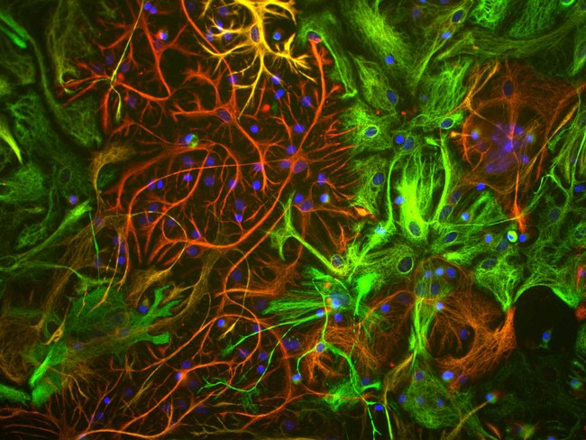 Vimentin Antibody - View of mixed neuron/glial cultures stained with Vimentin antibody (green) our our rabbit antibody to GFAP antibody (RPCA-GFAP, red). Vimentin is expressed alone in fibroblastic and endothelial cells, which are the flattened cells in the middle of the image which appear green. Astrocytes may express primarily GFAP, or GFAP and vimentin, and so appear red (GFAP only) or golden yellow (GFAP and Vimentin). In cells which express both GFAP and vimentin, the two protein assemble to produce heteropolymer filaments.