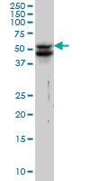 Vimentin Antibody - VIM monoclonal antibody (M01), clone 3E9 Western Blot analysis of VIM expression in HeLa.