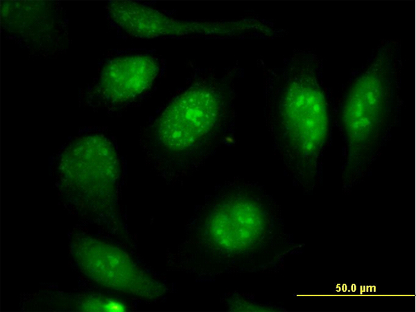 Vimentin Antibody - Immunofluorescence of monoclonal antibody to VIM on HeLa cell. [antibody concentration 40 ug/ml]