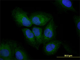 Vimentin Antibody - Immunofluorescence of monoclonal antibody to VIM on U-2 OS cell. [antibody concentration 10 ug/ml]