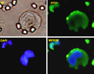 Vimentin Antibody - A-549 cells were stained with VIM-FITC labeled monoclonal antibody (Green). The cell nucleus were counterstained with DAPI (Blue).
