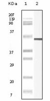 Vimentin Antibody - Western blot of Vimentin mouse mAb against truncated Vimentin recombinant protein.