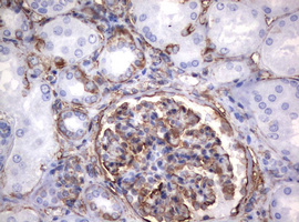 Vimentin Antibody - IHC of paraffin-embedded Human Kidney tissue using anti-VIM mouse monoclonal antibody. (Heat-induced epitope retrieval by 10mM citric buffer, pH6.0, 120°C for 3min).