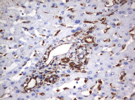 Vimentin Antibody - IHC of paraffin-embedded Human liver tissue using anti-VIM mouse monoclonal antibody. (Heat-induced epitope retrieval by 10mM citric buffer, pH6.0, 120°C for 3min).