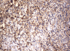 Vimentin Antibody - IHC of paraffin-embedded Human Ovary tissue using anti-VIM mouse monoclonal antibody. (Heat-induced epitope retrieval by 10mM citric buffer, pH6.0, 120°C for 3min).