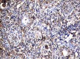 Vimentin Antibody - IHC of paraffin-embedded Human endometrium tissue using anti-VIM mouse monoclonal antibody. (Heat-induced epitope retrieval by 10mM citric buffer, pH6.0, 120°C for 3min).