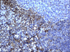 Vimentin Antibody - IHC of paraffin-embedded Human lymph node tissue using anti-VIM mouse monoclonal antibody. (Heat-induced epitope retrieval by 10mM citric buffer, pH6.0, 120°C for 3min).