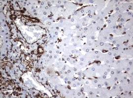 Vimentin Antibody - IHC of paraffin-embedded Human liver tissue using anti-VIM mouse monoclonal antibody.
