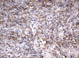 Vimentin Antibody - IHC of paraffin-embedded Human Ovary tissue using anti-VIM mouse monoclonal antibody.