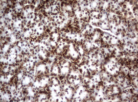 Vimentin Antibody - IHC of paraffin-embedded Human pancreas tissue using anti-VIM mouse monoclonal antibody.