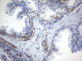Vimentin Antibody - IHC of paraffin-embedded Human prostate tissue using anti-VIM mouse monoclonal antibody.