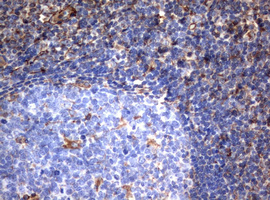 Vimentin Antibody - IHC of paraffin-embedded Human lymph node tissue using anti-VIM mouse monoclonal antibody.