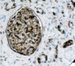Vimentin Antibody - IHC of Vimentin on FFPE Cervix tissue. This image was taken for the unmodified form of this product. Other forms have not been tested.