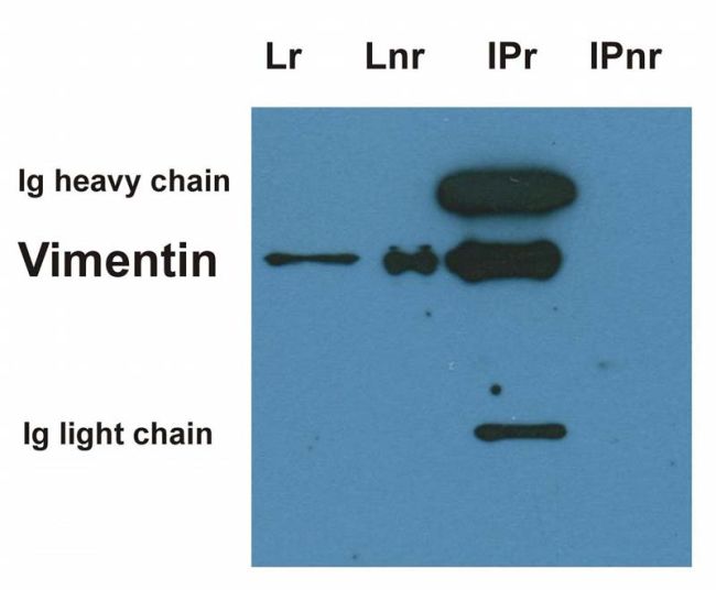 Vimentin Antibody - Vimentin Antibody in Immunoprecipitation (IP)