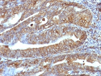 Vimentin Antibody - Formalin-fixed, paraffin-embedded human uterus stained with anti-Vimentin antibody.  This image was taken for the unmodified form of this product. Other forms have not been tested.