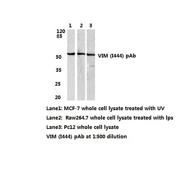 Vimentin Antibody - Western blot of VIM(I444) pAb in extracts from MCF-7 whole cell lysate treated with UV,Raw264.7 whole cell lysate treated with LPS and PC12 whole cells.