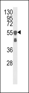 Vimentin Antibody - Western blot of VIME Antibody in A375 cell line lysates (35 ug/lane). VIME (arrow) was detected using the purified antibody.