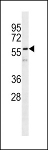 Vimentin Antibody - VIME Antibody western blot of HeLa cell line lysates (35 ug/lane). The VIME antibody detected the VIME protein (arrow).