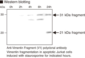 Vimentin Antibody