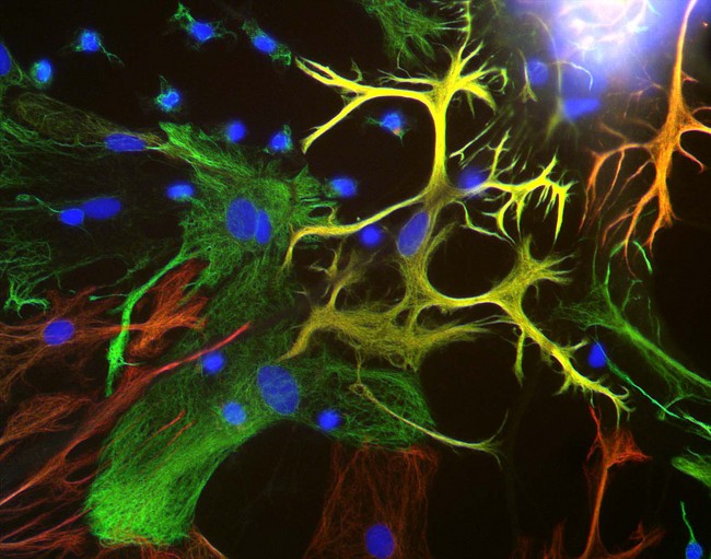 Vimentin Antibody - View of mixed neuron/glial cultures stained with Vimentin antibody (green) and rabbit antibody to GFAP antibody (red). Vimentin is the sole cytoplasmic intermediate filament subunit expressed in fibroblastic, microglial and endothelial cells. The flattened cells in the middle of the image which appear green are fibroblasts. Astrocytes may express primarily GFAP, or a mix of GFAP and vimentin, and so appear red (GFAP only) or golden yellow (GFAP and Vimentin). In cells which express both GFAP and vimentin, the two protein assemble to produce heteropolymer filaments.