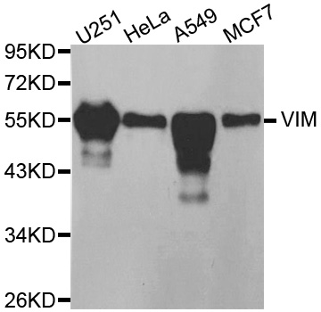 Vimentin Antibody - Western blot analysis of extracts of various cell lines.