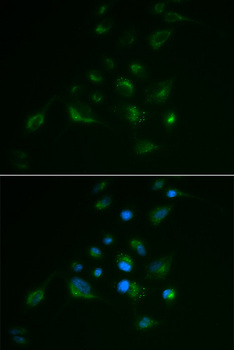 Vimentin Antibody - Immunofluorescence analysis of A549 cells.