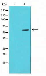 Vimentin Antibody - Western blot of 293 cell lysate using Vimentin Antibody