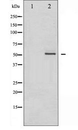 Vimentin Antibody - Western blot of Vimentin expression in Nocodazole treated A549 whole cell lysates,The lane on the left is treated with the antigen-specific peptide.