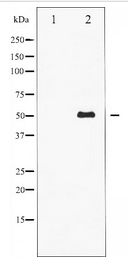 Vimentin Antibody - Western blot of Vimentin expression in HepG2 whole cell lysates,The lane on the left is treated with the antigen-specific peptide.