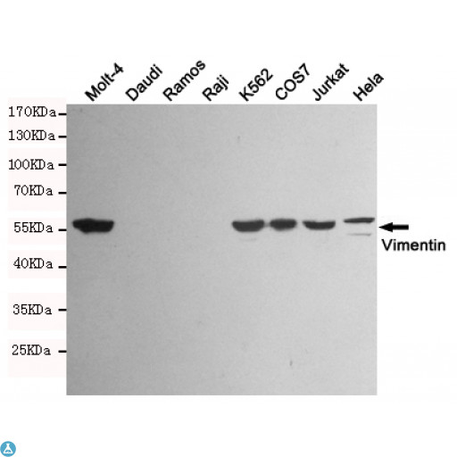 Vimentin Antibody - Western blot detection of Vimentin in Molt-4, K562, COS7, Jurkat, Hela and Vimentin negative cell (Daudi, Ramos, Raji) lysates using Vimentin mouse mAb (1:1000 diluted). Predicted band size: 57KDa. Observed band size: 57KDa.