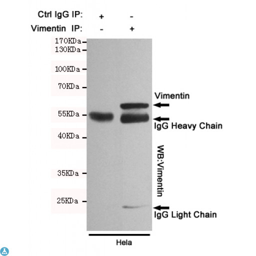 Vimentin Antibody - Immunoprecipitation analysis of Hela cell lysates using Vimentin mouse mAb.