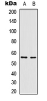 Vimentin Antibody - Western blot analysis of Vimentin expression in HepG2 (A); A549 (B) whole cell lysates.