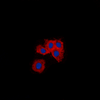 Vimentin Antibody - Immunofluorescent analysis of Vimentin staining in A549 cells. Formalin-fixed cells were permeabilized with 0.1% Triton X-100 in TBS for 5-10 minutes and blocked with 3% BSA-PBS for 30 minutes at room temperature. Cells were probed with the primary antibody in 3% BSA-PBS and incubated overnight at 4 deg C in a humidified chamber. Cells were washed with PBST and incubated with a DyLight 594-conjugated secondary antibody (red) in PBS at room temperature in the dark. DAPI was used to stain the cell nuclei (blue).