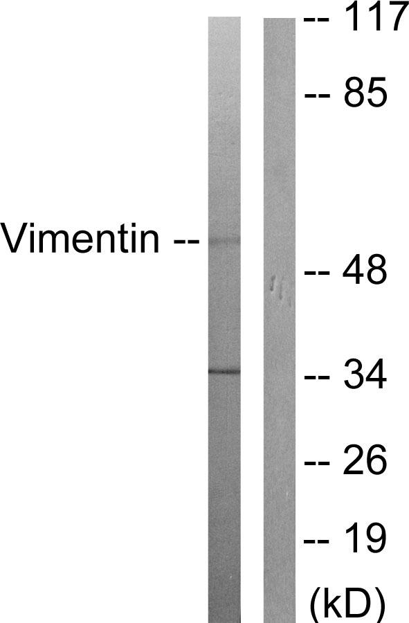 Vimentin Antibody - Western blot analysis of extracts from 293 cells, treated with EGF (200ng/ml, 30mins), using Vimentin (Ab-83) antibody.